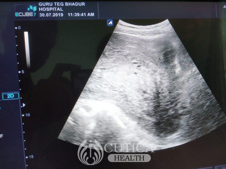 ultrasonography_t20_WxWjOw-768x576